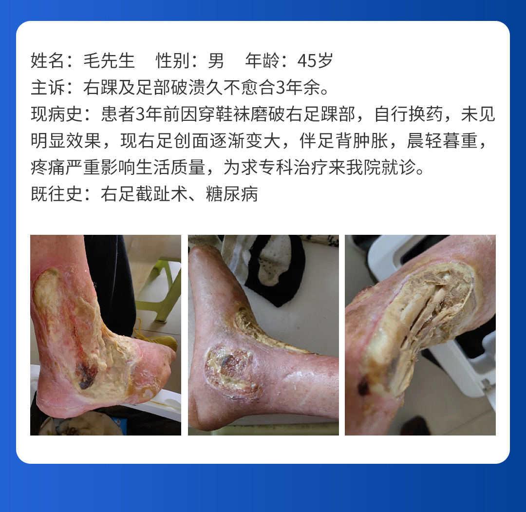 【北(běi)京市(shì)中西(xī)醫(yī)結合周圍血管疑難病會(huì)診中心】首期會(huì)診圓滿成功！(圖8)