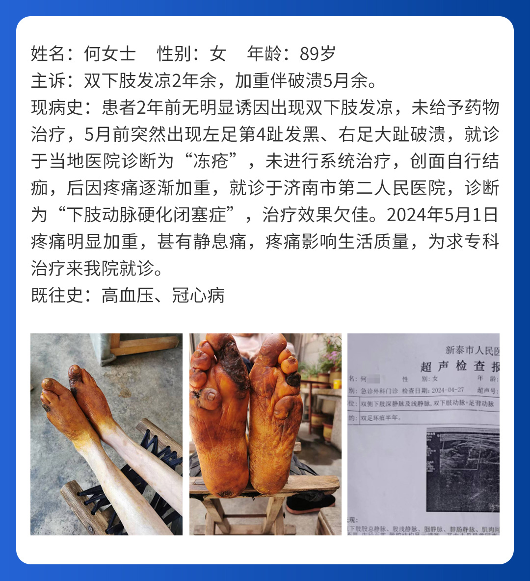 【北(běi)京市(shì)中西(xī)醫(yī)結合周圍血管疑難病會(huì)診中心】首期會(huì)診圓滿成功！(圖7)